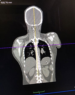 ct-scan-of-torso-on-coronal-plane.jpg Three-Dimensional Scan and CT Scan
