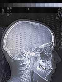 xray-of-human-head.jpg xray of human skull
