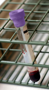 principles_of_dna_04_-_abo_typing.jpeg photo of a test tube filled with blood