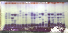 principles_of_dna_04_-_iso-enzyme_and_protein_typing.jpeg photo of iso enzyme and protein typing