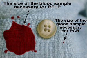 principles_of_dna_04_-_pcr.jpeg Zoomed in photo of a shirt button with a large blood splatter on the left hand side, and a small dot of blood on the right side.