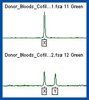 principles_of_dna_06_-_biological_sex_typing.jpeg Image of two graphs. One shows a line graph with an X chromosome, the second shows a line graph with both an X and a Y chromosome