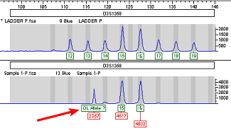 Microvariants and OL Alleles Microvariants and OL Alleles