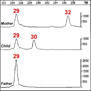Mutations and Paternity An example of a mutation in the STR locus D21S11 of the father causing allele mismatch in the child.