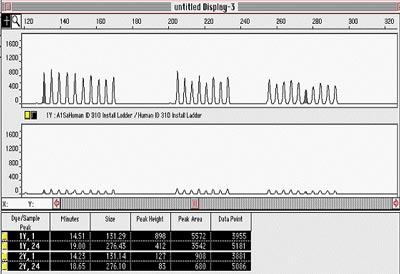 Difference in ladder peak height using formamide with low conductivity (upper electropheragram) and data using formamide with high conductivity (lower electropheragram) Difference in ladder peak height using formamide with low conductivity (upper electropheragram) and data using formamide with high conductivity (lower electropheragram)