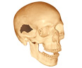 firearms_examiner_02_-_human_skull.jpg Image of a human skull with a bullet wound