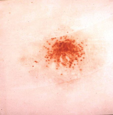 firearms_examiner_12_-_chemistry.jpg Modified Griess Test results at 3 inches