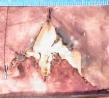 firearms_examiner_12_-_contact_shot.jpg Contact shot with tearingof the material and soot around the entrance hole.