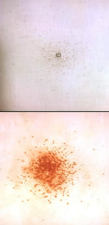 firearms_examiner_12_-_nitrite_residues.jpg Modified Griess Test results of shot at three inches