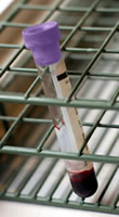 reference_sample_collection.jpg Photo of a blood sample vial in a lab