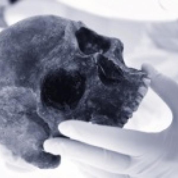 Technician handling a human skull